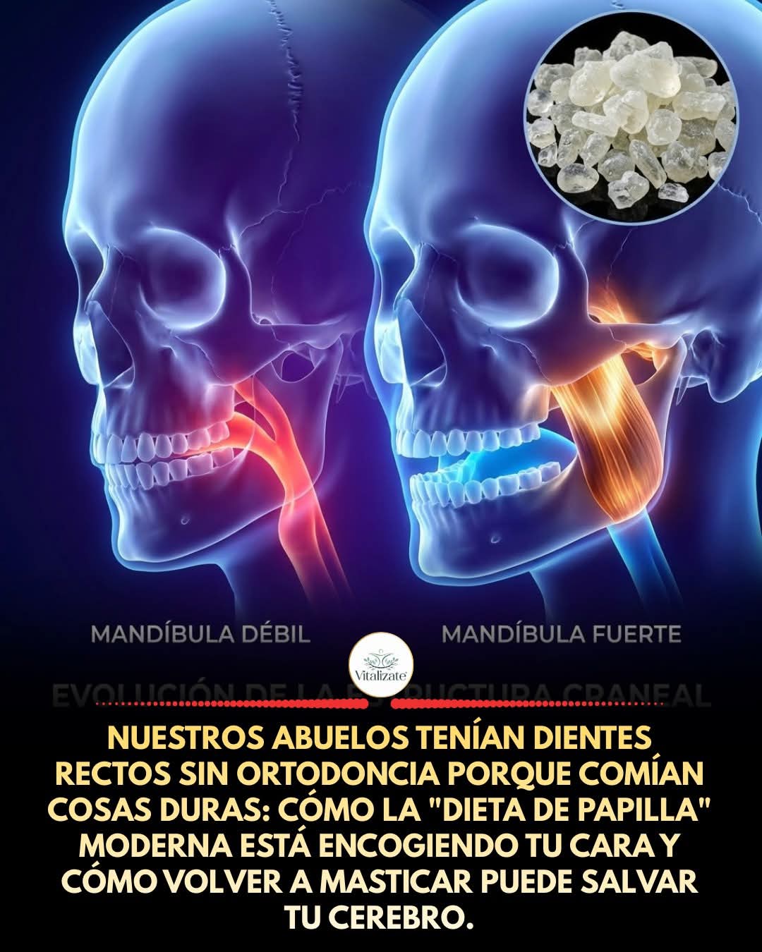 mandibula, fuerte