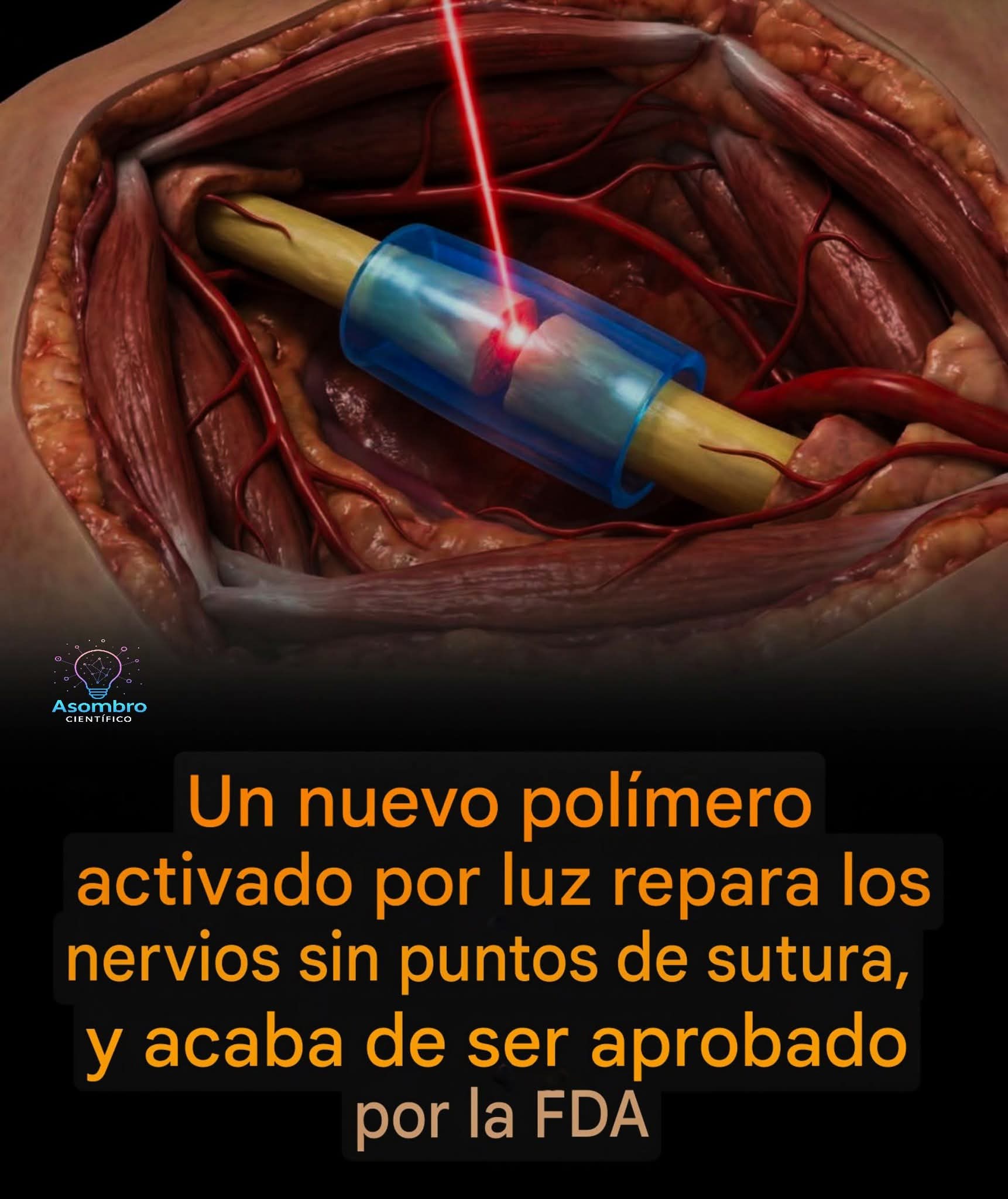 polimero, nervios