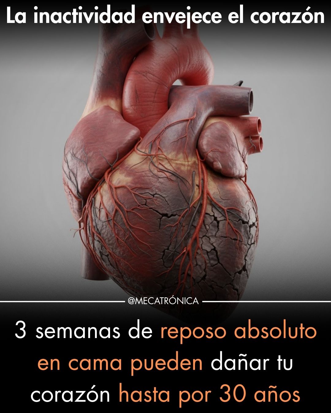 reposo